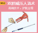 国际最新标准人流术——双腔减压人流术